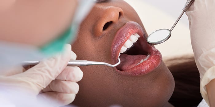 Dental Visit Checking Teeth Gums