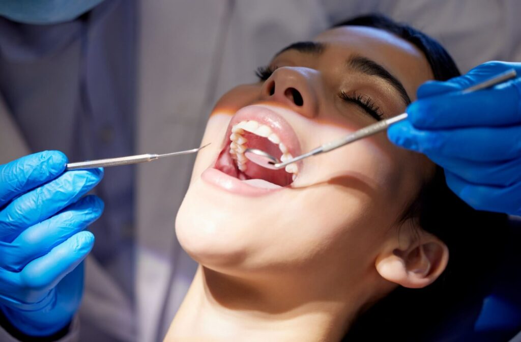 Decay Under A Dental Crown
