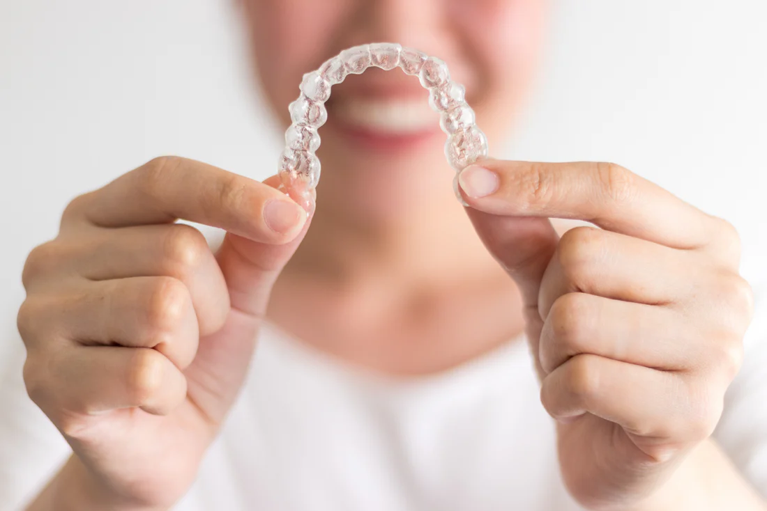 Angel Aligners