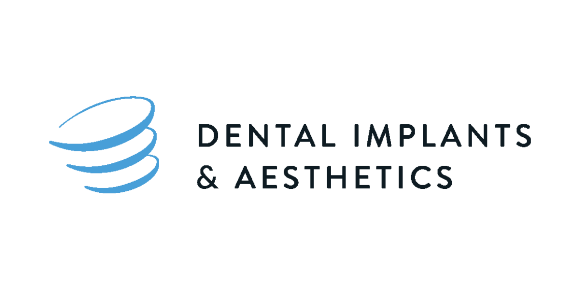 Dental Implants Aesthetics Stacked e1738300070394