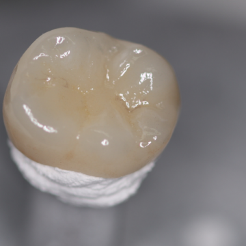 Same Day Crowns e1741836246676