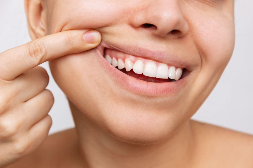 Understanding the Importance of Gum Health