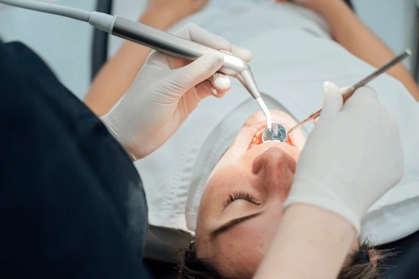 top signs of dental decay