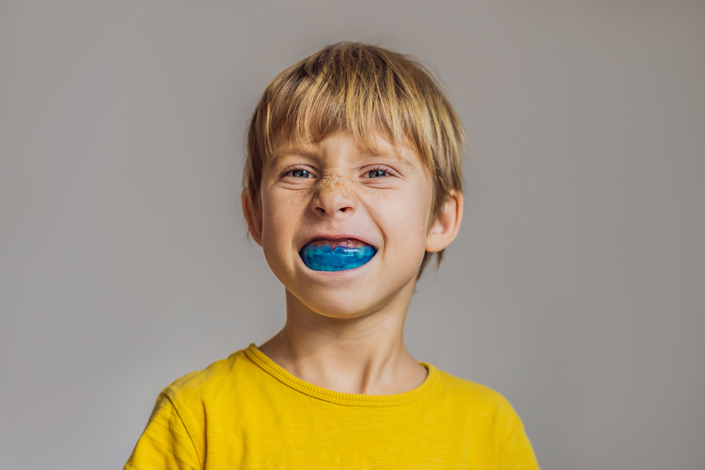 Why Mouthguards are Essential