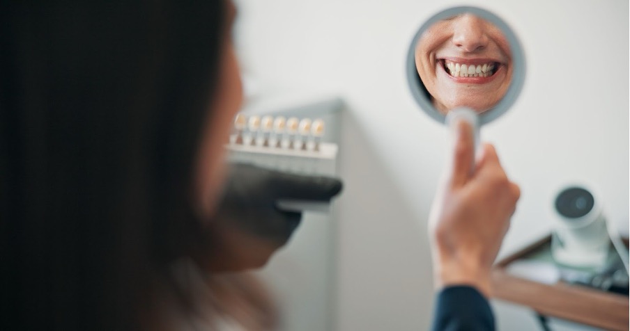 Can You Whiten Composite Bonding?