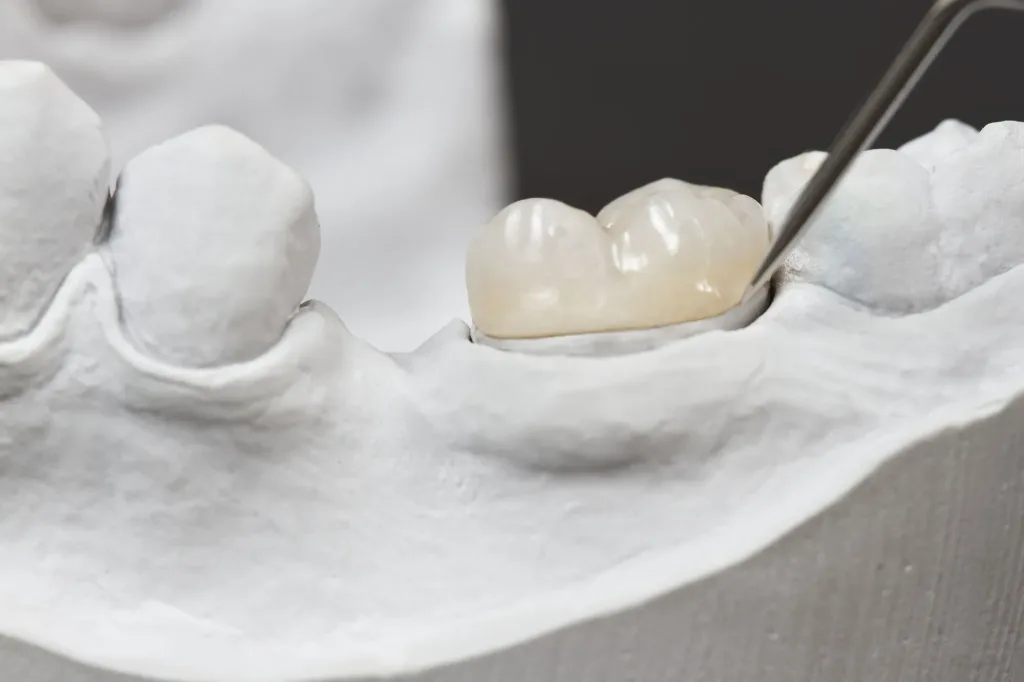 Zirconia Dental Crown