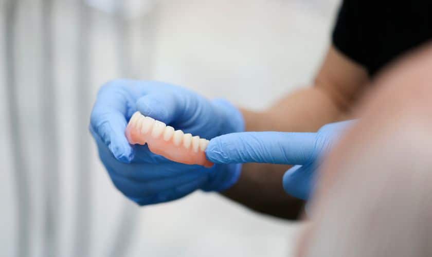 A Guide to Modern Dentures
