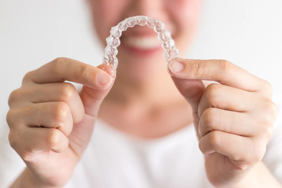 Clear Aligners Gold Coast